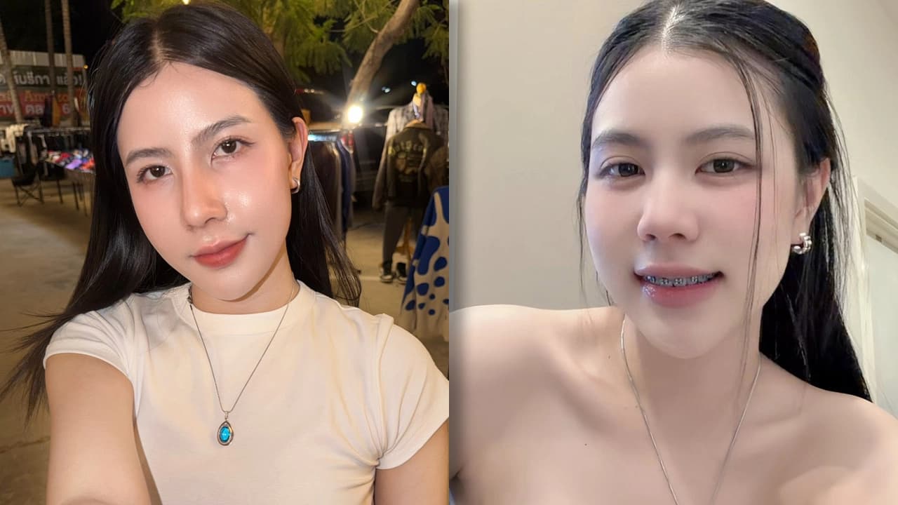 เปิดลุคใหม่ “กระต่าย พรรณนิภา” หลังทำจมูก แต่แอบเครียดหนักคนทักไม่สวยเท่าเดิม